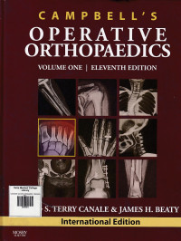 Image of Campbell’s operative orthopaedics. vol.01.