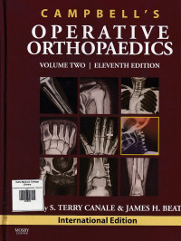 Image of Campbell’s operative orthopaedics. vol.02