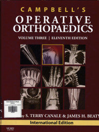 Image of Campbell’s  operative orthopaedics.Vol.03