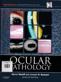 Image of Ocular pathology