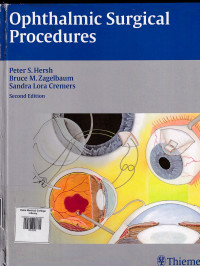 Image of Ophthalmic surgical procedures