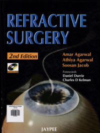 Image of Refractive Surgery