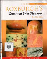 Image of Roxburgh's common skin diseases : Common skin diseases