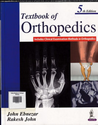 Image of Textbook of orthopaedics
