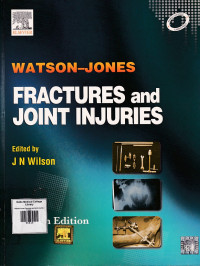Image of Watson-Jones Fractures and joint injuries